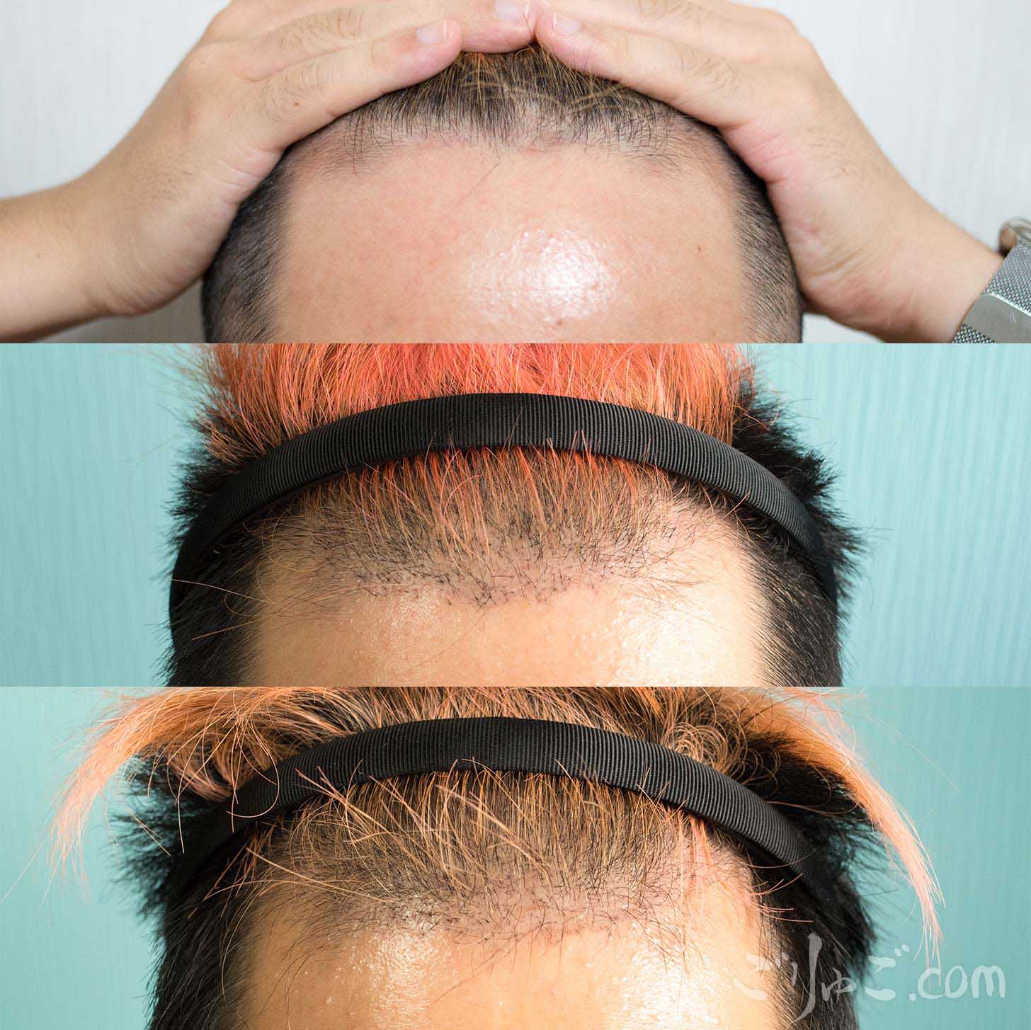 c996d2fe6ec2564bf3ec218c66d2bced